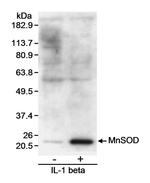 MnSOD Antibody in Western Blot (WB)