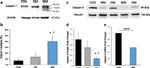 Mu-Calpain Antibody in Western Blot (WB)