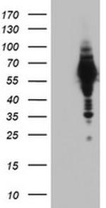 NAB1 Antibody in Western Blot (WB)