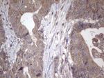 NAB2 Antibody in Immunohistochemistry (Paraffin) (IHC (P))