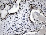 NABP1 Antibody in Immunohistochemistry (Paraffin) (IHC (P))