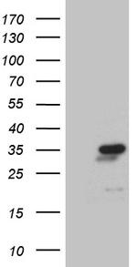 NABP1 Antibody in Western Blot (WB)