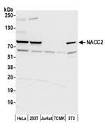 NACC2/BTBD14A Antibody in Western Blot (WB)