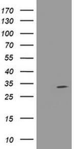 NANP Antibody in Western Blot (WB)