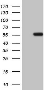 NARS2 Antibody in Western Blot (WB)