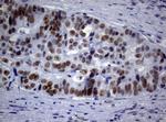 NBN Antibody in Immunohistochemistry (Paraffin) (IHC (P))