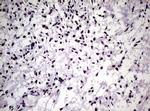 NBN Antibody in Immunohistochemistry (Paraffin) (IHC (P))