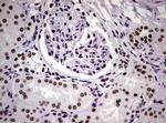 NBN Antibody in Immunohistochemistry (Paraffin) (IHC (P))