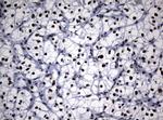 NBN Antibody in Immunohistochemistry (Paraffin) (IHC (P))