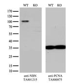 NBN Antibody in Western Blot (WB)