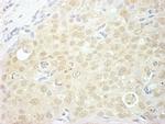 NCBP1/CBP80 Antibody in Immunohistochemistry (IHC)