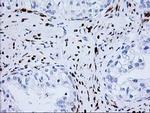 NDEL1 Antibody in Immunohistochemistry (Paraffin) (IHC (P))