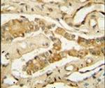 NDUFAF3 Antibody in Immunohistochemistry (IHC)