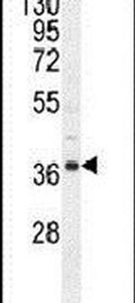 NDUFAF3 Antibody in Western Blot (WB)