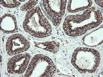 NDUFB10 Antibody in Immunohistochemistry (Paraffin) (IHC (P))