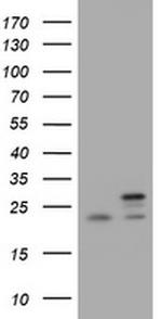 NDUFB10 Antibody in Western Blot (WB)