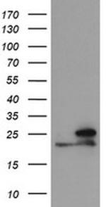 NDUFB10 Antibody in Western Blot (WB)