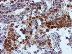 NDUFB9 Antibody in Immunohistochemistry (Paraffin) (IHC (P))