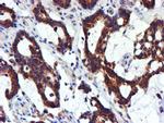 NDUFB9 Antibody in Immunohistochemistry (Paraffin) (IHC (P))