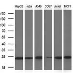 NDUFB9 Antibody in Western Blot (WB)