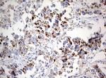 NDUFS2 Antibody in Immunohistochemistry (Paraffin) (IHC (P))