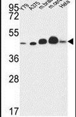 NDUFS2 Antibody in Western Blot (WB)