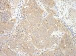 NEDD4L Antibody in Immunohistochemistry (IHC)