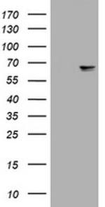 NEFL Antibody in Western Blot (WB)