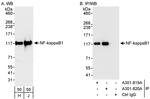 NF-kappaB1 Antibody in Western Blot (WB)