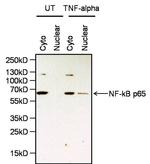 NFkB p65 Antibody in Western Blot (WB)