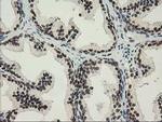 NHEJ1 Antibody in Immunohistochemistry (Paraffin) (IHC (P))