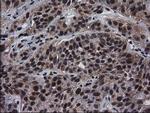 NHEJ1 Antibody in Immunohistochemistry (Paraffin) (IHC (P))