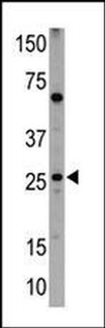 BNIP1 Antibody in Western Blot (WB)