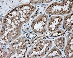 NIT1 Antibody in Immunohistochemistry (Paraffin) (IHC (P))