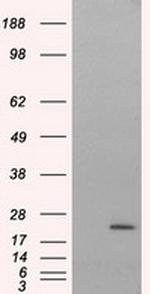 NIT2 Antibody in Western Blot (WB)