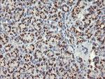 NKIRAS1 Antibody in Immunohistochemistry (Paraffin) (IHC (P))