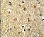 NKRF Antibody in Immunohistochemistry (IHC)