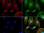 NME1 Antibody in Immunocytochemistry (ICC/IF)