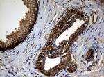 NME1 Antibody in Immunohistochemistry (Paraffin) (IHC (P))