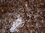 NME1 Antibody in Immunohistochemistry (Paraffin) (IHC (P))