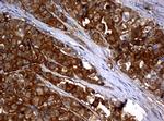 NME1 Antibody in Immunohistochemistry (Paraffin) (IHC (P))