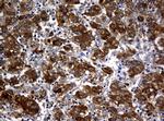 NME1 Antibody in Immunohistochemistry (Paraffin) (IHC (P))