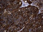 NME1 Antibody in Immunohistochemistry (Paraffin) (IHC (P))