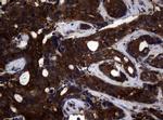 NME1 Antibody in Immunohistochemistry (Paraffin) (IHC (P))