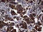 NME1 Antibody in Immunohistochemistry (Paraffin) (IHC (P))