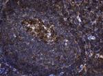 NME1 Antibody in Immunohistochemistry (Paraffin) (IHC (P))