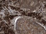 NME1 Antibody in Immunohistochemistry (Paraffin) (IHC (P))