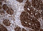 NME1 Antibody in Immunohistochemistry (Paraffin) (IHC (P))