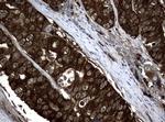 NME1 Antibody in Immunohistochemistry (Paraffin) (IHC (P))