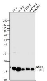 NME2 Antibody in Western Blot (WB)